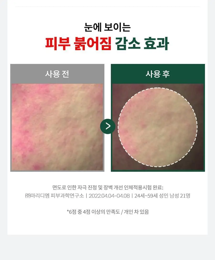 [new] 닥터지 레드 블레미쉬 포 맨 토너/진정올인원 2종 기획 (+미니어처 2종) 상세페이지 34